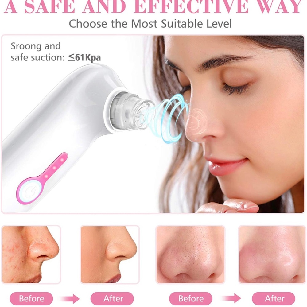 Morttic Blackhead Remover Vacuum NIB - Picture 4 of 8